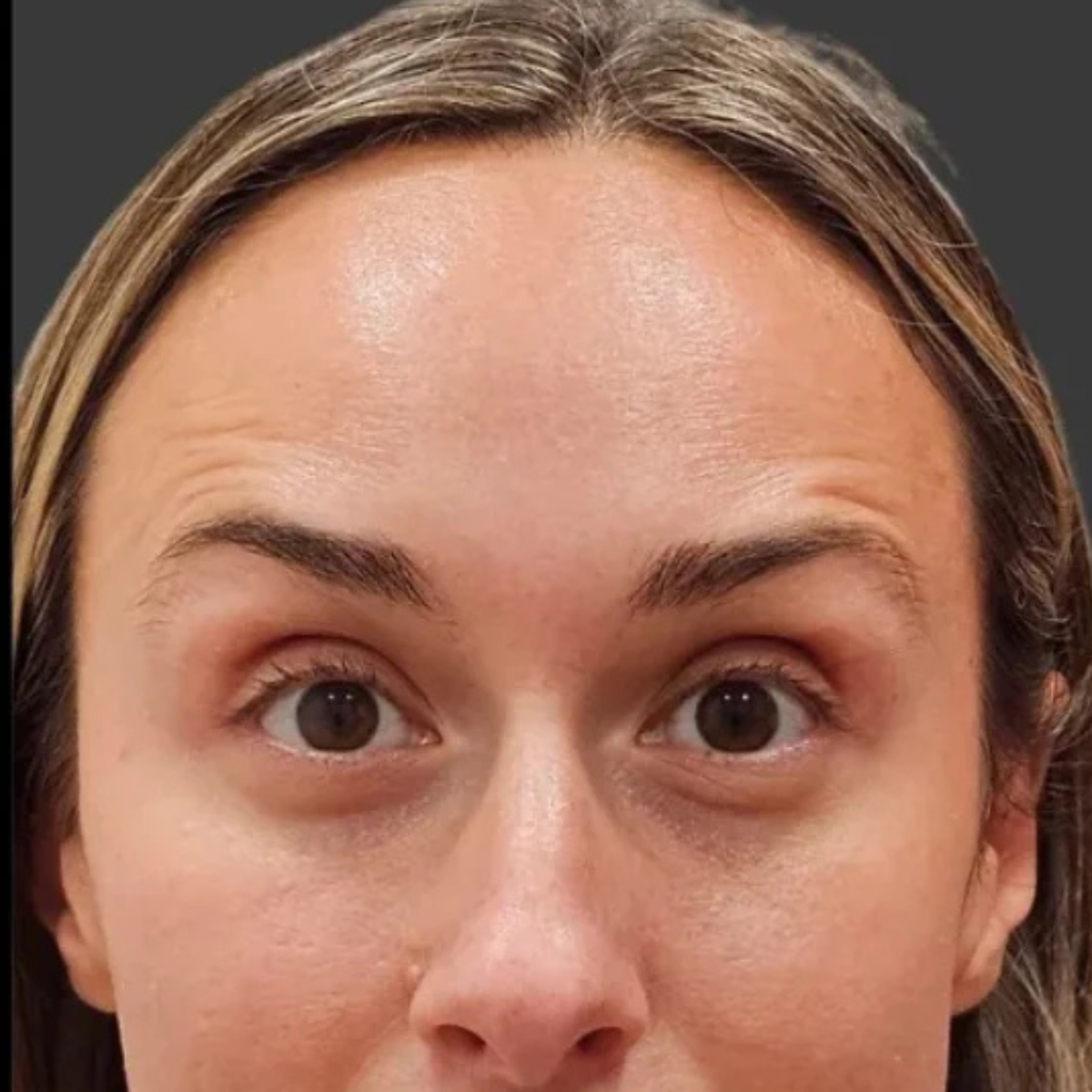 Después